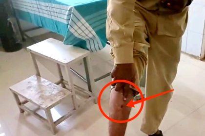 Kalburgi ಕಾಂಡೆಕ್ಟರ್ ಮೇಲೆ ಪೊಲೀಸರಿಂದ ಹಲ್ಲೆ